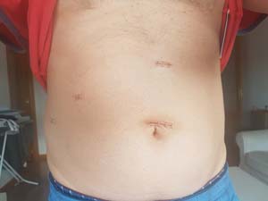 Portada de Casi Muero